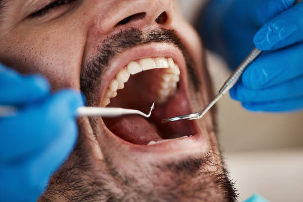 Best Pediatric Emergency Dentist in Vinton, VA