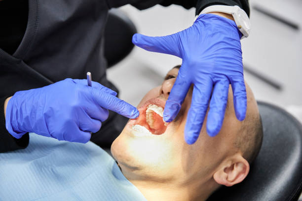 Best Emergency Dental Surgery in Vinton, VA